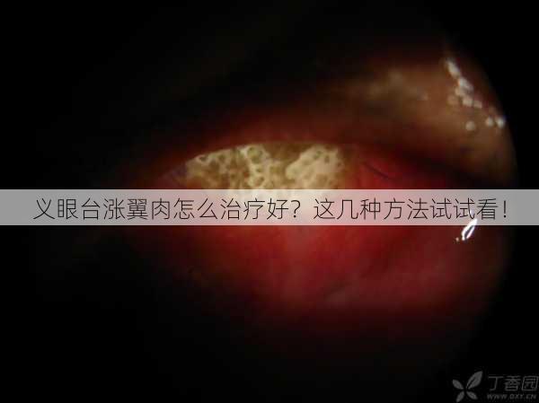 义眼台涨翼肉怎么治疗好？这几种方法试试看！
