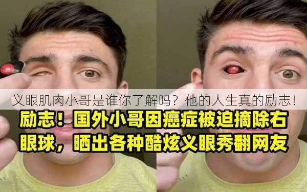 义眼肌肉小哥是谁你了解吗？他的人生真的励志！