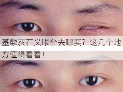 基麟灰石义眼台去哪买？这几个地方值得看看！