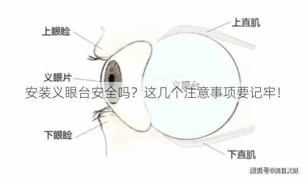 安装义眼台安全吗？这几个注意事项要记牢！