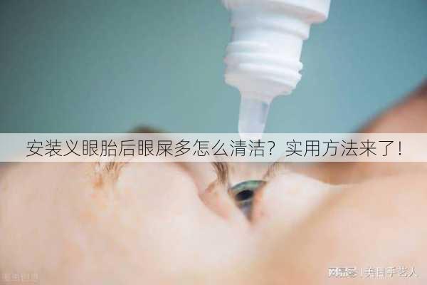 安装义眼胎后眼屎多怎么清洁？实用方法来了！