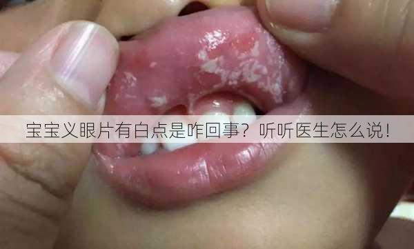 宝宝义眼片有白点是咋回事？听听医生怎么说！