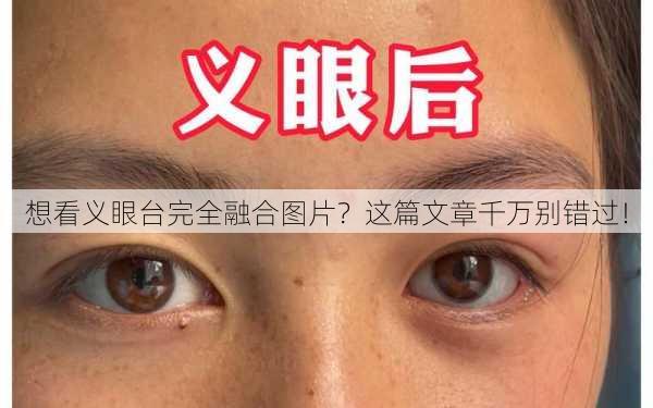 想看义眼台完全融合图片？这篇文章千万别错过！
