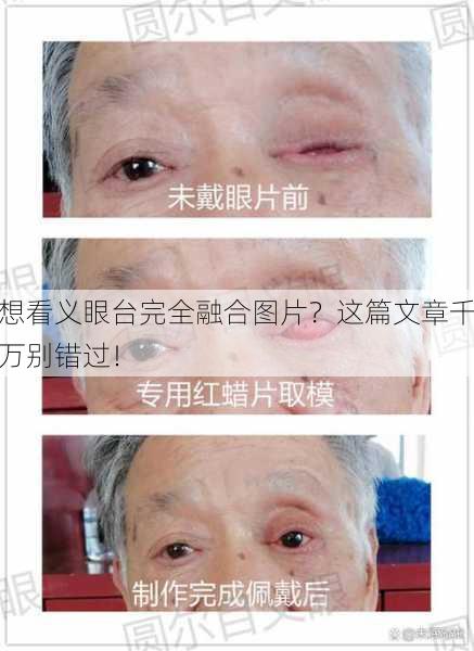 想看义眼台完全融合图片？这篇文章千万别错过！