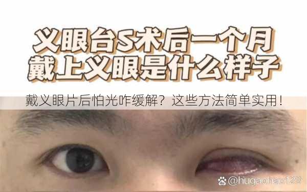 戴义眼片后怕光咋缓解？这些方法简单实用！