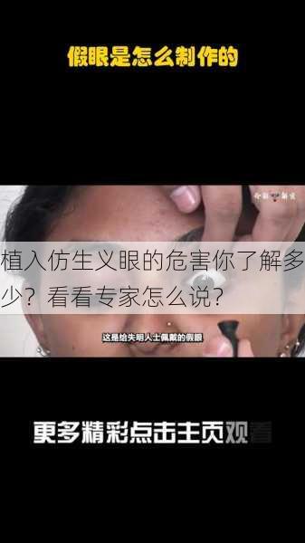 植入仿生义眼的危害你了解多少？看看专家怎么说？