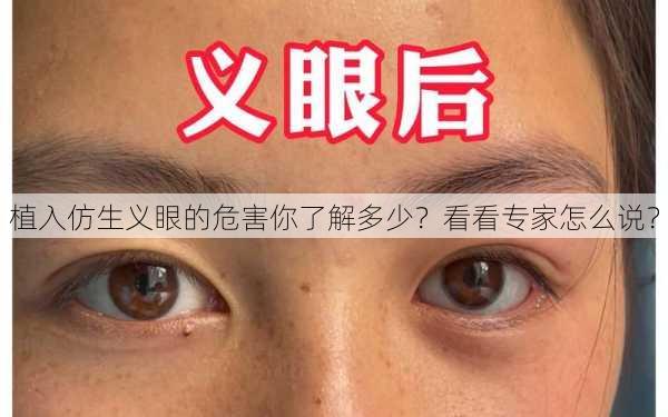 植入仿生义眼的危害你了解多少？看看专家怎么说？