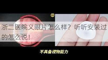 浙二医院义眼片怎么样？听听安装过的怎么说！